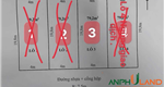 Chỉ còn 1 lô F0 tại TDP Phường Thủy Nguyên ( xã Hoàng Lâm), TP Hải Phòng